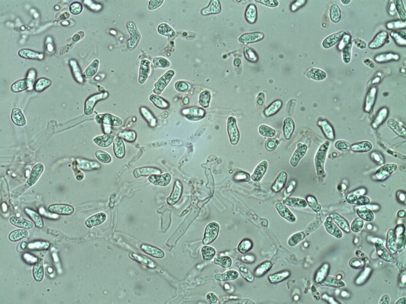 Squamanita odorata- Chlamydosporen