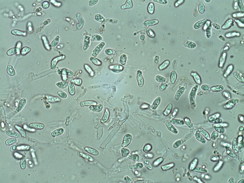 Squamanita odorata- Chlamydosporen